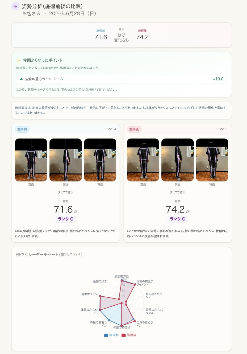 Re:Coreの姿勢分析。施術前と施術後を並べて比較できます